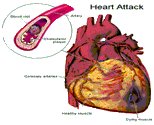 cara mengobati gagal jantung